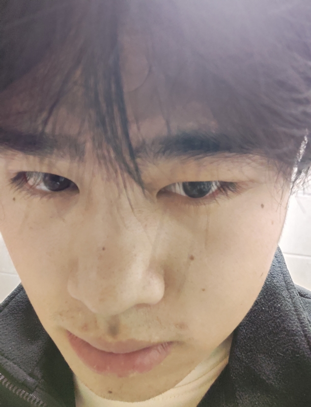 伤男的第一张照片--河南上门女婿服务网